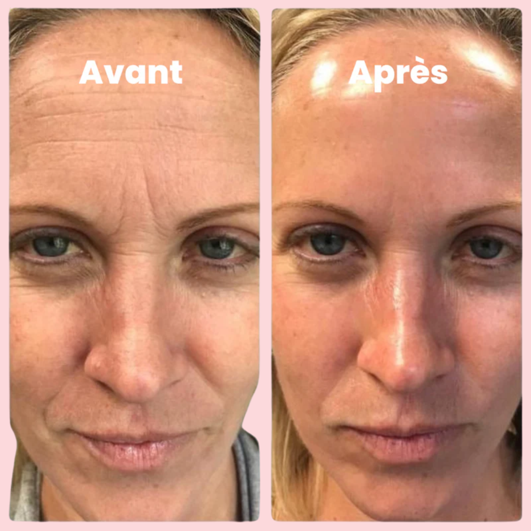 Masques au Bio-Collagène